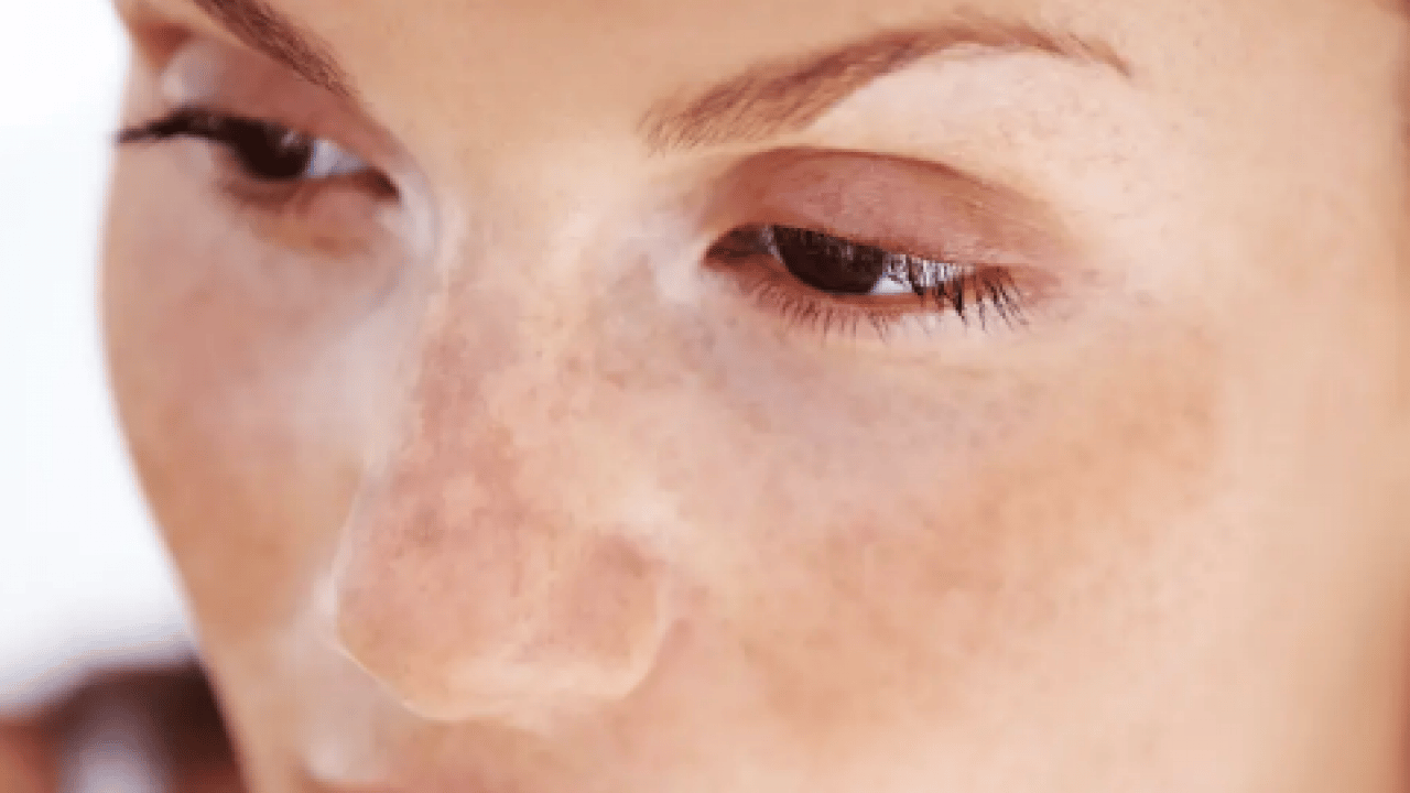 Foto - Yarardan çok zarar vermeyin... pH 5,5 dengesine dikkat! Hangi sabun hangi cilt tipine iyi gelir? 