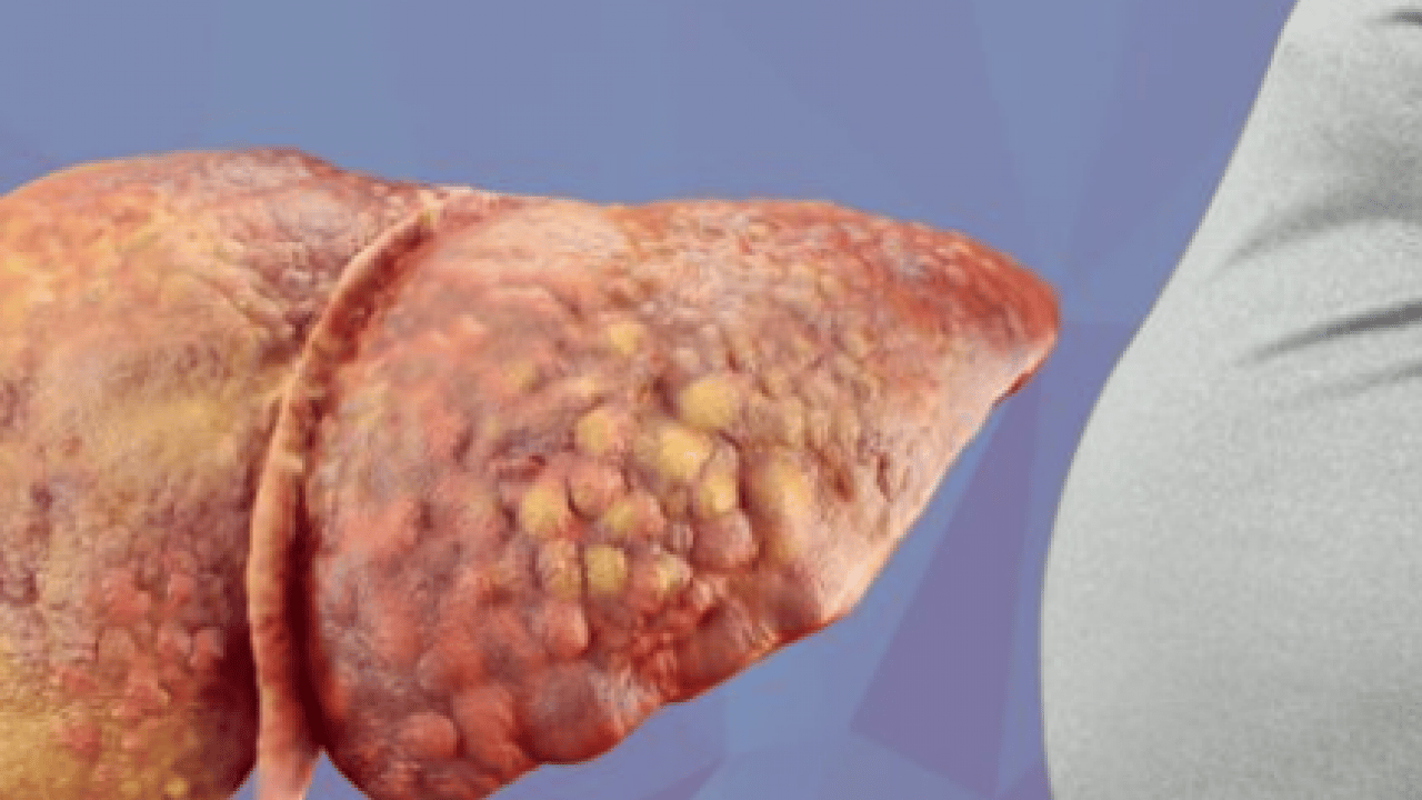 Foto - Pişman olmayın, aman dikkat! Her gün soframızda! Meğer karaciğer yağlanmasını tetikliyormuş