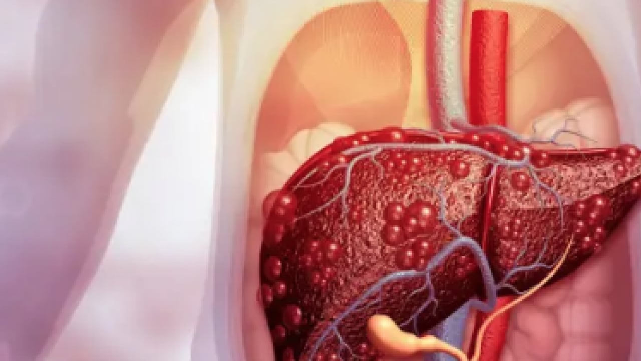 Foto - Pişman olmayın, aman dikkat! Her gün soframızda! Meğer karaciğer yağlanmasını tetikliyormuş