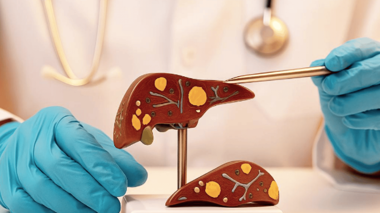 Pişman olmayın, aman dikkat! Her gün soframızda! Meğer karaciğer yağlanmasını tetikliyormuş