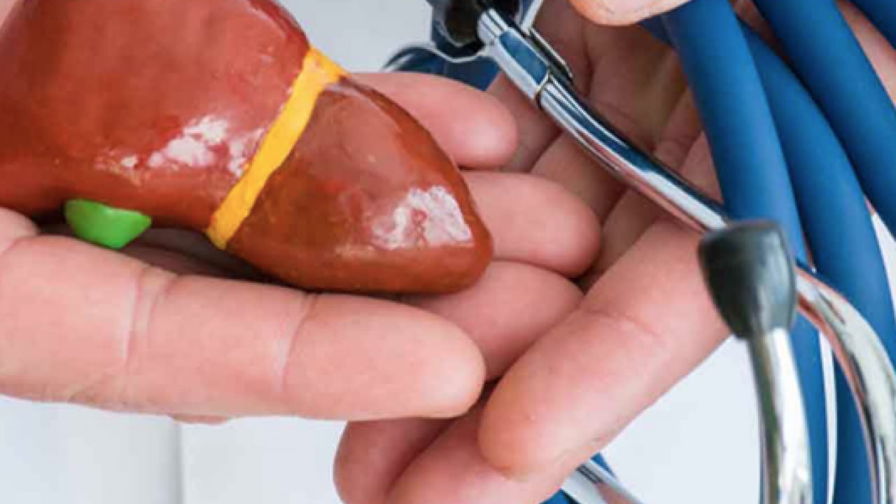 Foto - Pişman olmayın, aman dikkat! Her gün soframızda! Meğer karaciğer yağlanmasını tetikliyormuş