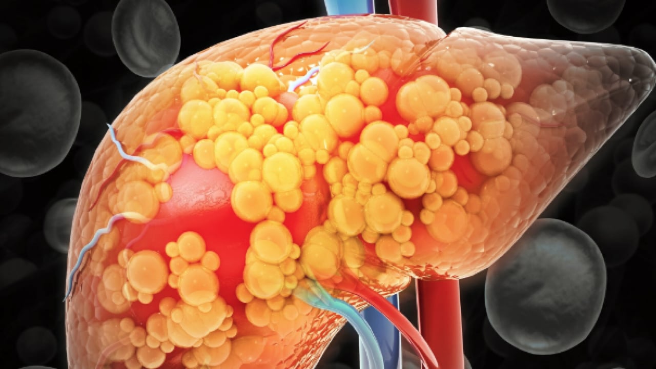 Foto - Pişman olmayın, aman dikkat! Her gün soframızda! Meğer karaciğer yağlanmasını tetikliyormuş