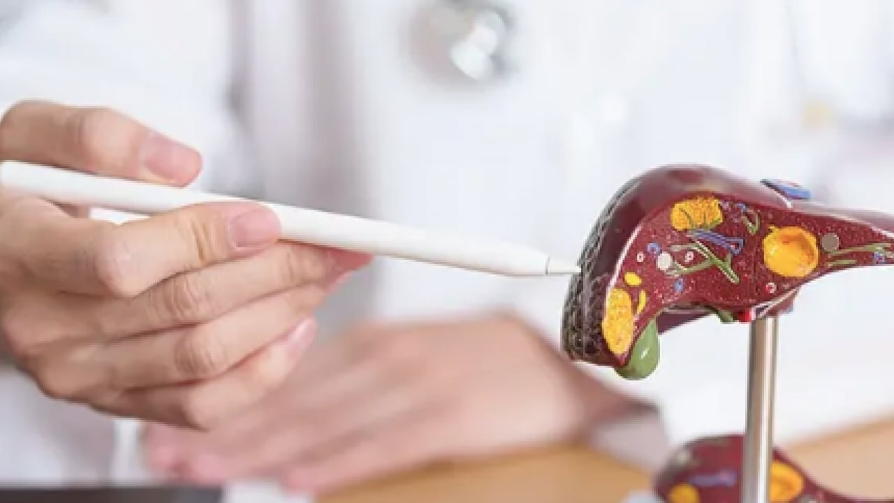 Foto - Pişman olmayın, aman dikkat! Her gün soframızda! Meğer karaciğer yağlanmasını tetikliyormuş