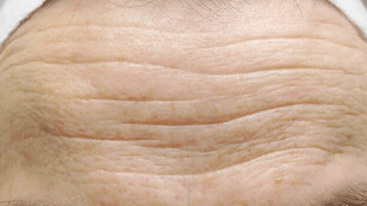 Foto - Pratik C vitamini maskesi: Pancar maskesi! Kadınlar süt ekleyin! Yüzde parlak görünüm kim istiyor ise mutlaka denemeli!