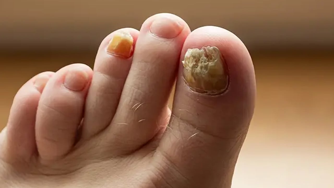 Foto - Prof. Dr. Canan Karatay'dan çok konuşulacak çıkış: Elma kabuğu önerdi! Ezber bozdu... Önce onu önermişti