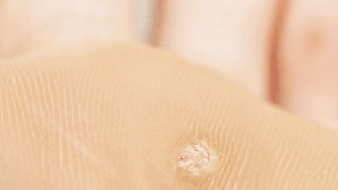 Foto - Prof. Dr. Ahmet Metin, yaz aylarında tatil nedeniyle ortaya çıkıyor diyerek ayak sağlığı uyarısı yaptı