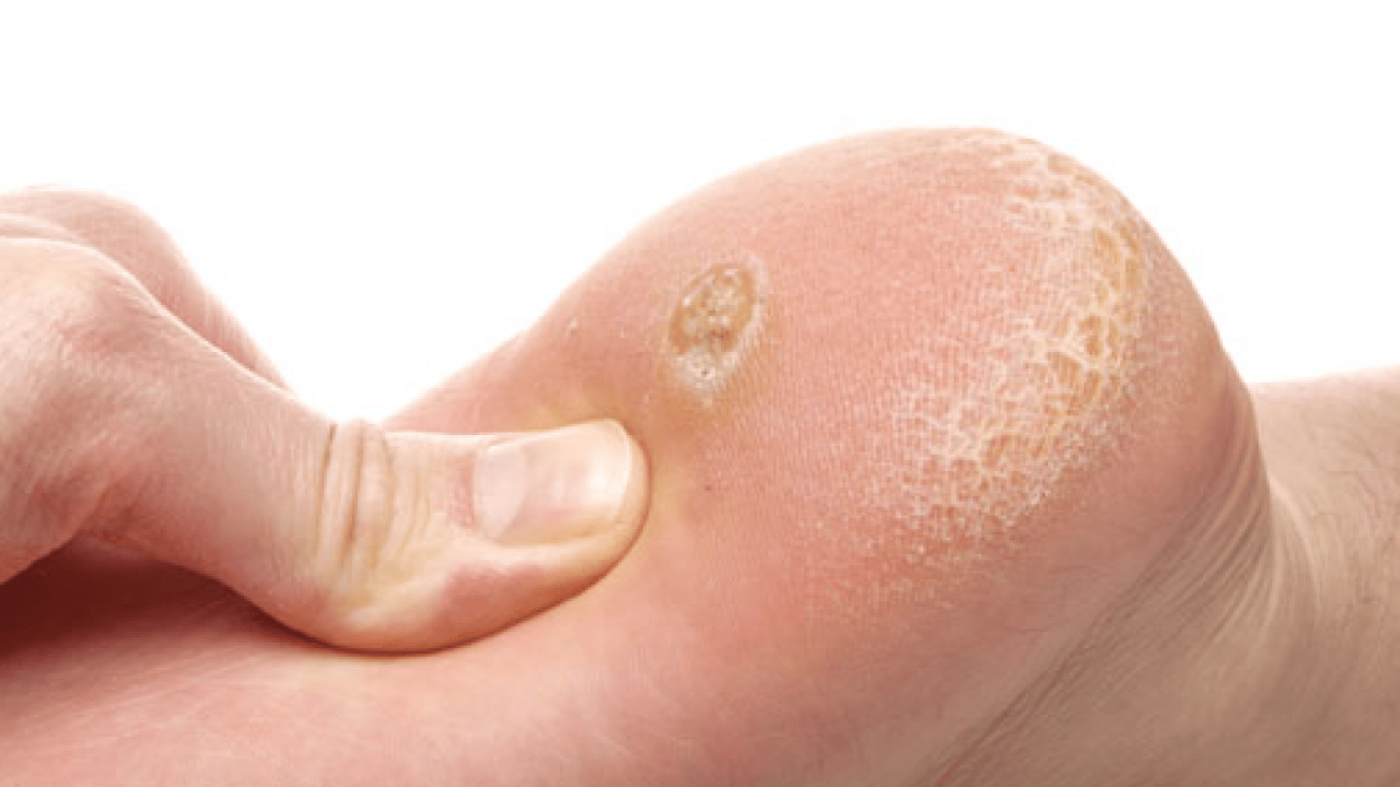 Foto - Prof. Dr. Ahmet Metin, yaz aylarında tatil nedeniyle ortaya çıkıyor diyerek ayak sağlığı uyarısı yaptı