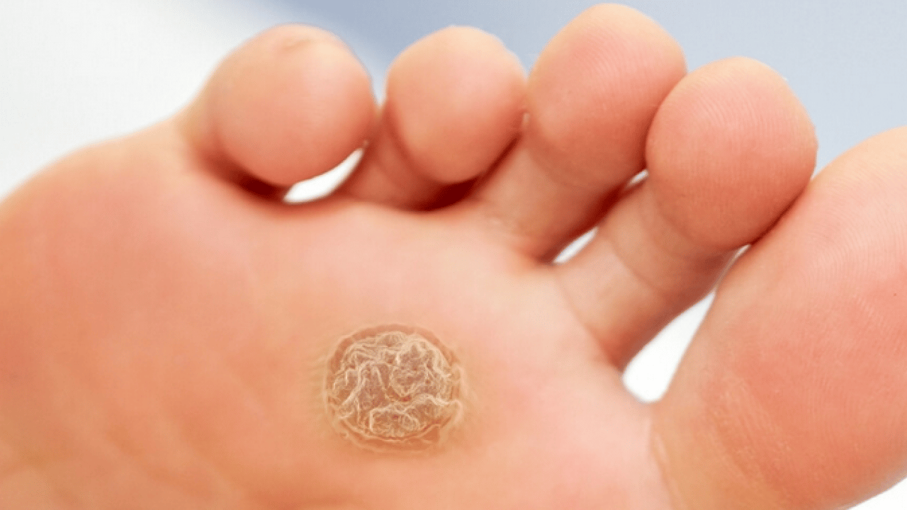 Foto - Prof. Dr. Ahmet Metin, yaz aylarında tatil nedeniyle ortaya çıkıyor diyerek ayak sağlığı uyarısı yaptı