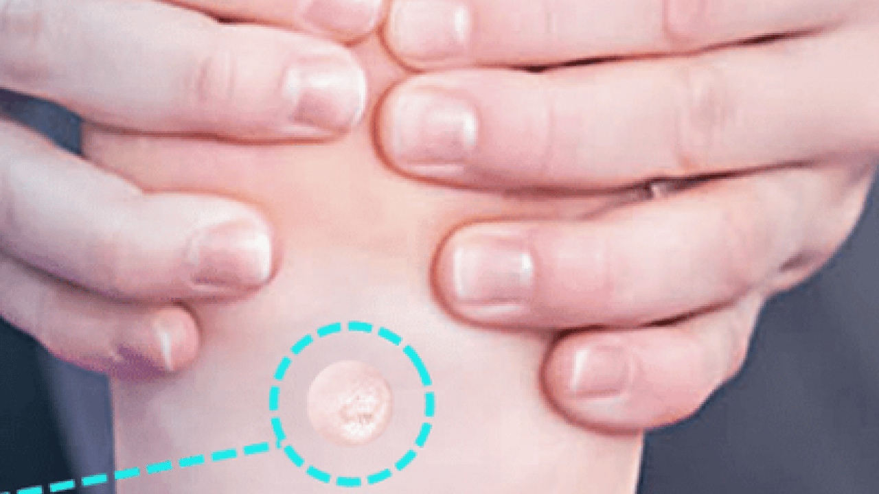 Foto - Prof. Dr. Ahmet Metin, yaz aylarında tatil nedeniyle ortaya çıkıyor diyerek ayak sağlığı uyarısı yaptı