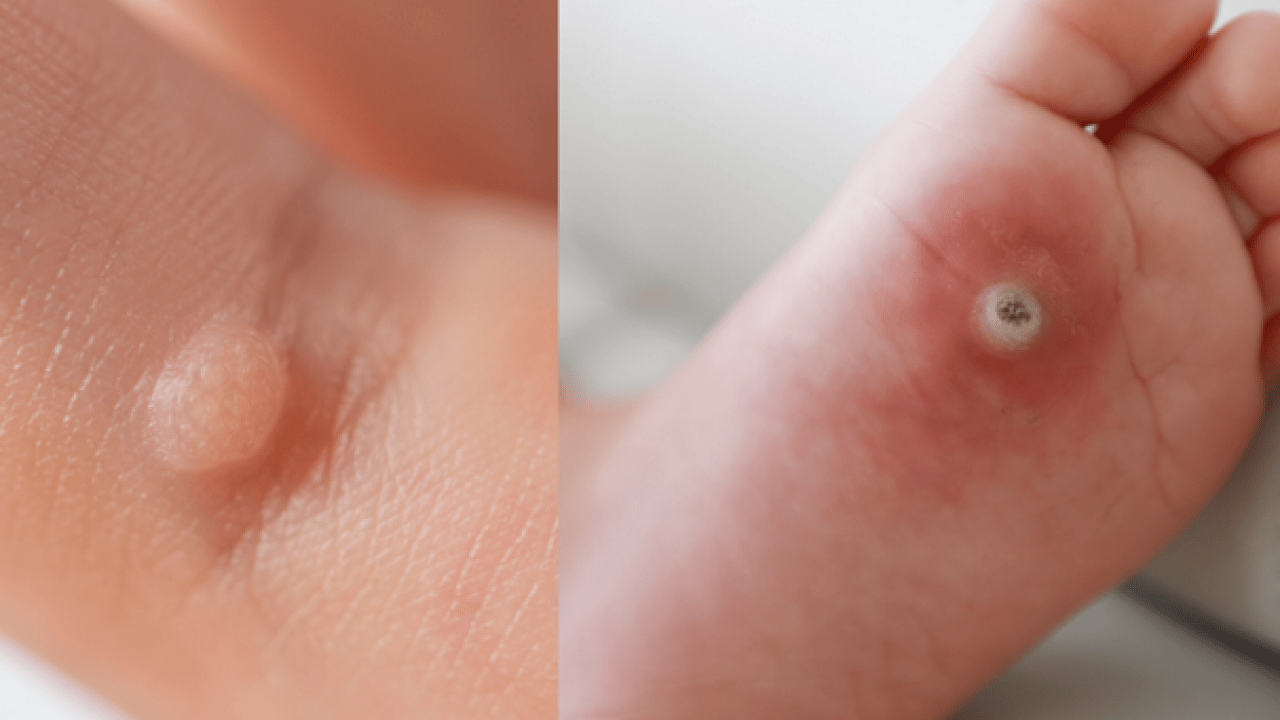 Foto - Prof. Dr. Ahmet Metin, yaz aylarında tatil nedeniyle ortaya çıkıyor diyerek ayak sağlığı uyarısı yaptı