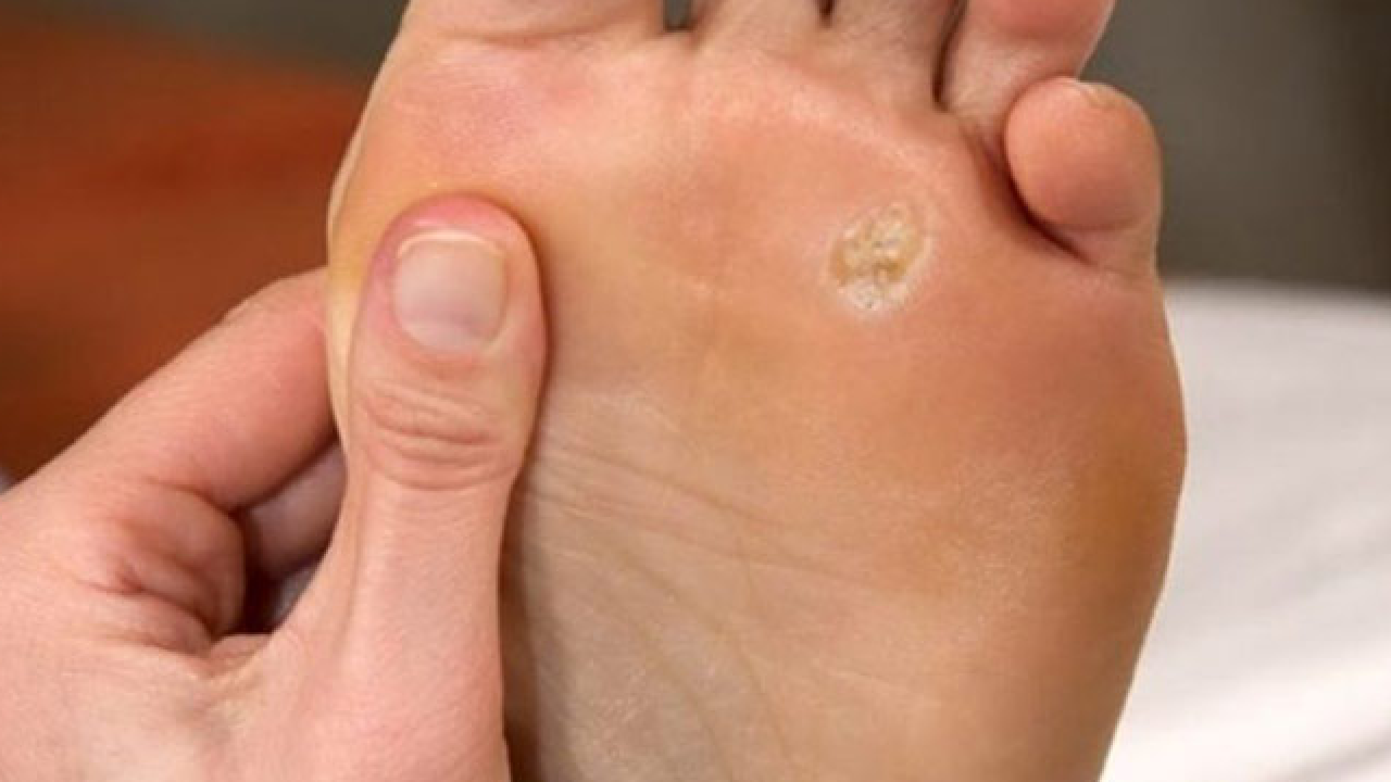 Foto - Prof. Dr. Ahmet Metin, yaz aylarında tatil nedeniyle ortaya çıkıyor diyerek ayak sağlığı uyarısı yaptı