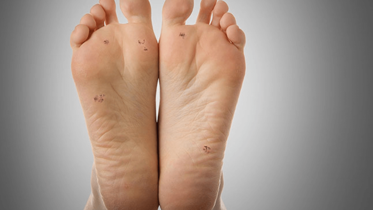 Foto - Prof. Dr. Ahmet Metin, yaz aylarında tatil nedeniyle ortaya çıkıyor diyerek ayak sağlığı uyarısı yaptı