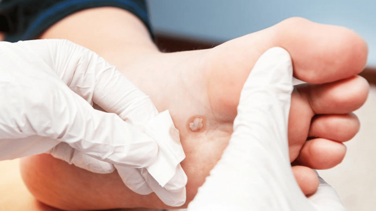 Foto - Prof. Dr. Ahmet Metin, yaz aylarında tatil nedeniyle ortaya çıkıyor diyerek ayak sağlığı uyarısı yaptı