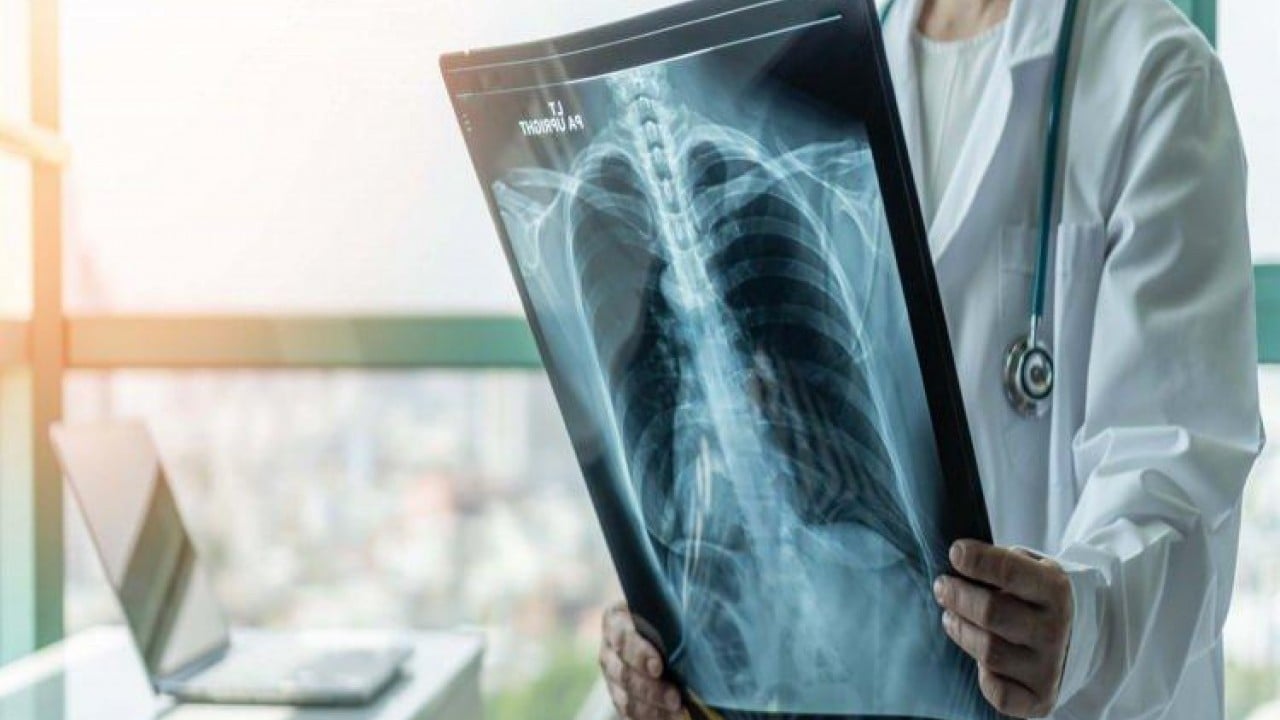 Foto - Prof. Dr. Şener uyardı! Süperenfeksiyona karşı ücretsiz aşınızı olun