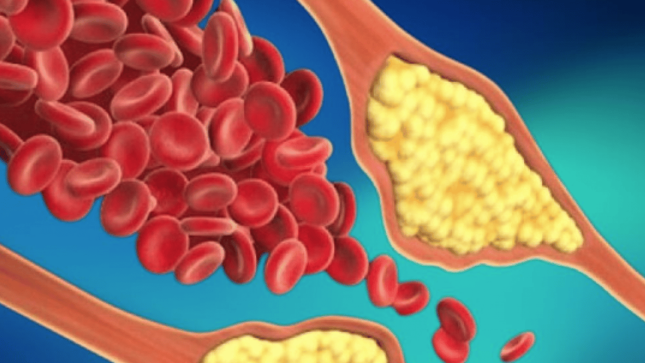 Foto - Prof. Dr. tek tek açıkladı: Yalnızca kolesterol yüksekliği başlı başına bir problemdir