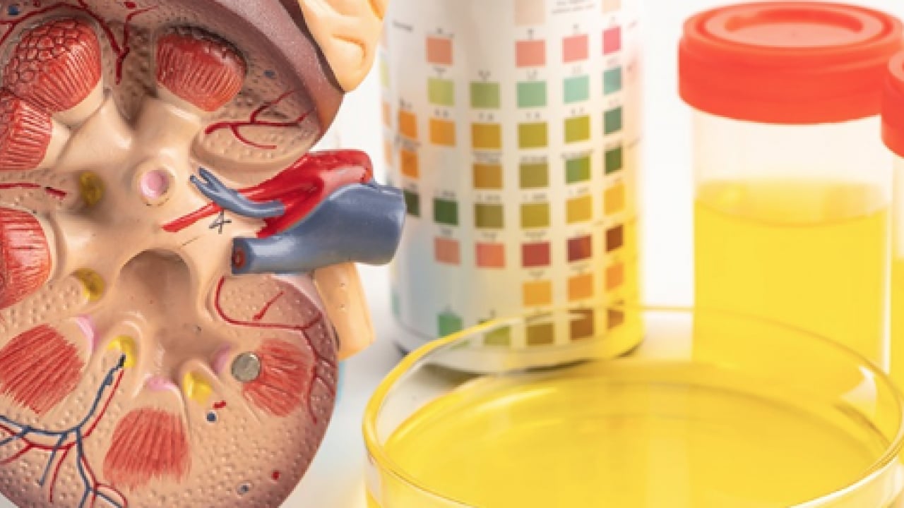 Foto - Prof. Dr. tek tek açıkladı: Yalnızca kolesterol yüksekliği başlı başına bir problemdir