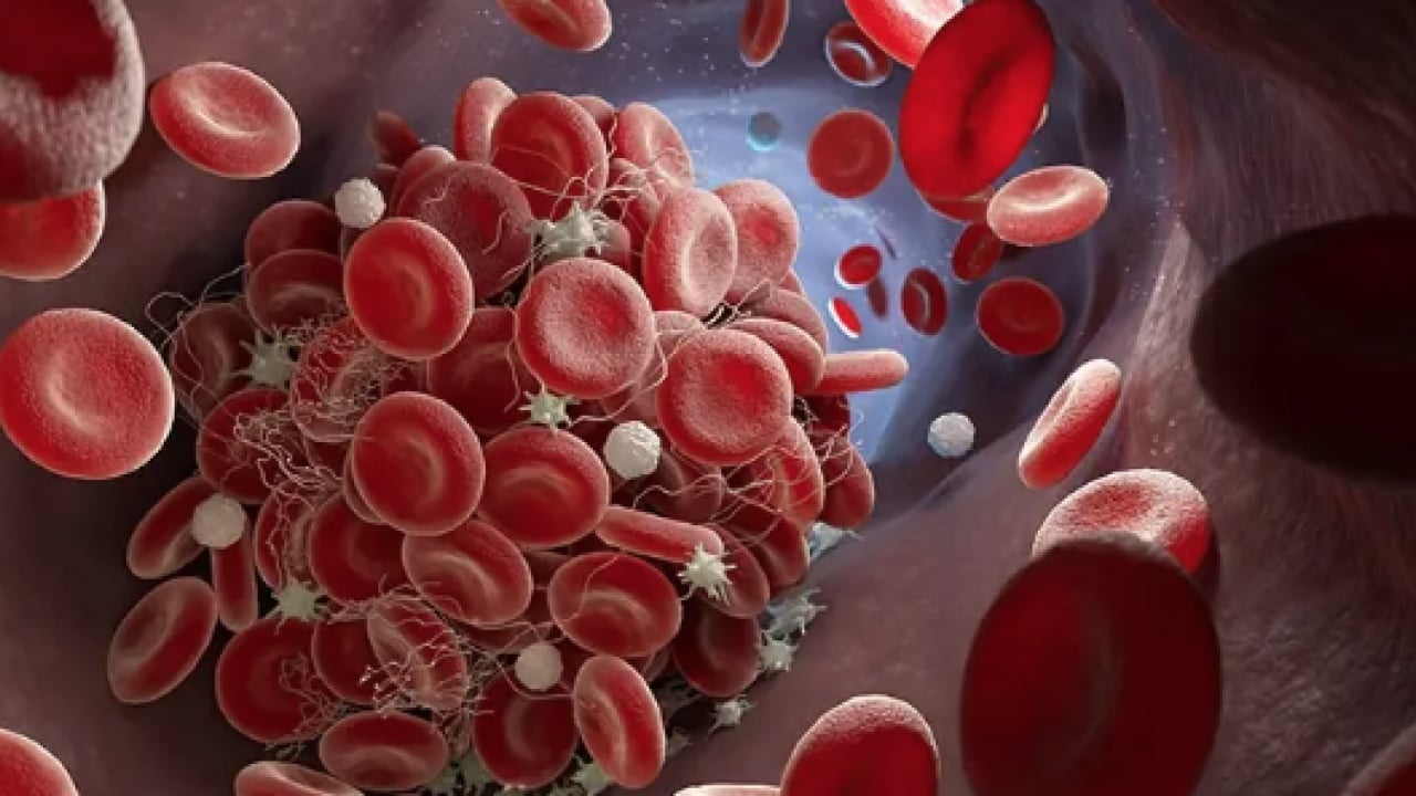 Foto - Prof. Dr. tek tek açıkladı: Yalnızca kolesterol yüksekliği başlı başına bir problemdir