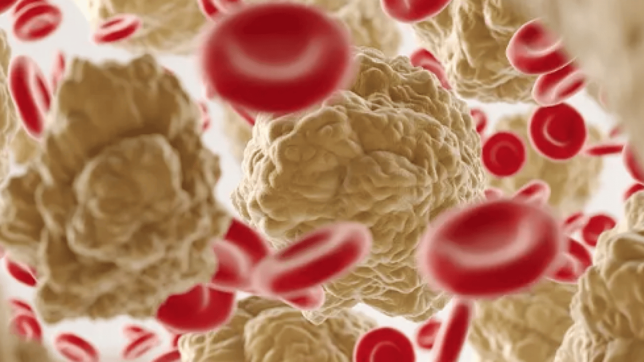 Foto - Prof. Dr. tek tek açıkladı: Yalnızca kolesterol yüksekliği başlı başına bir problemdir