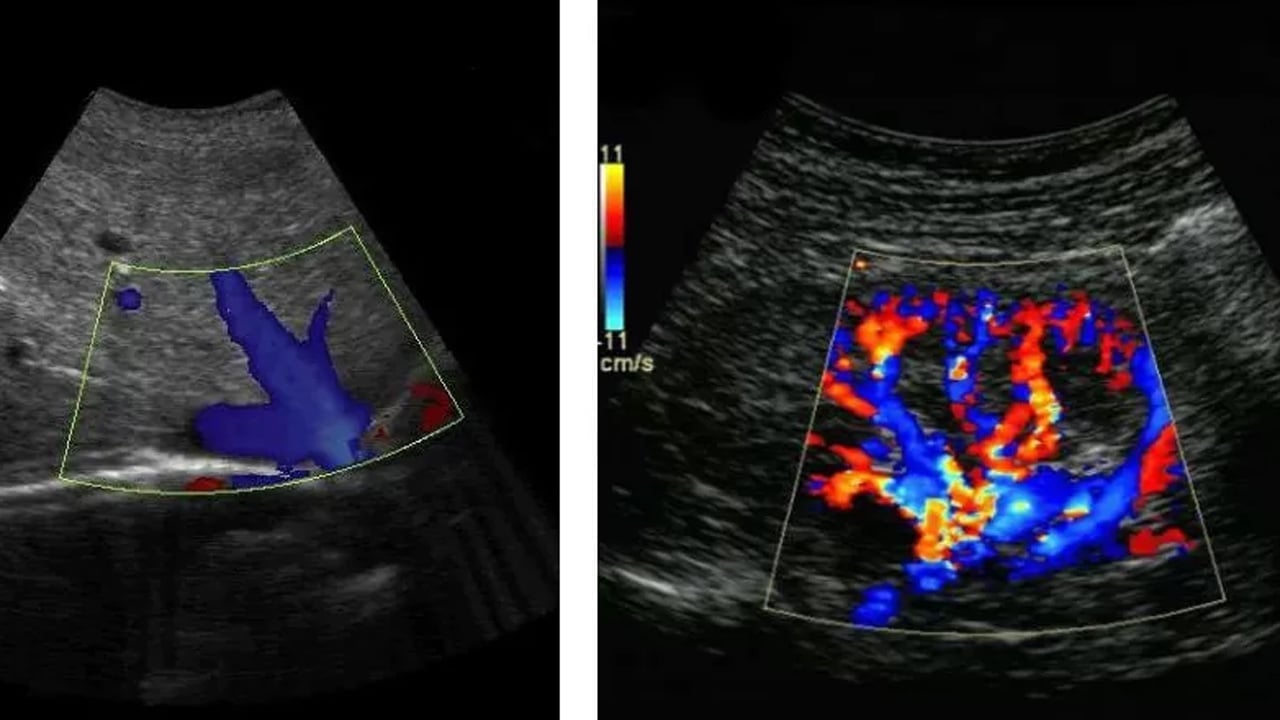 Foto - Prof. Dr. Topgül: Şişkinlik sanılan şey kitle olabilir! Bu işarete dikkat...İşte o belirtisini duyurdu