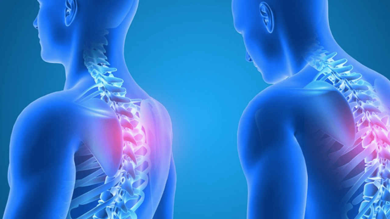 Foto - Prof. Dr'dan kritik açıklamalar! Buffalo Hump ve kronik ağrılar uyarısı geldi...