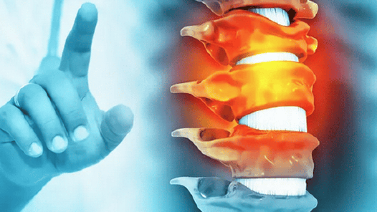 Foto - Prof. Dr'dan kritik açıklamalar! Buffalo Hump ve kronik ağrılar uyarısı geldi...