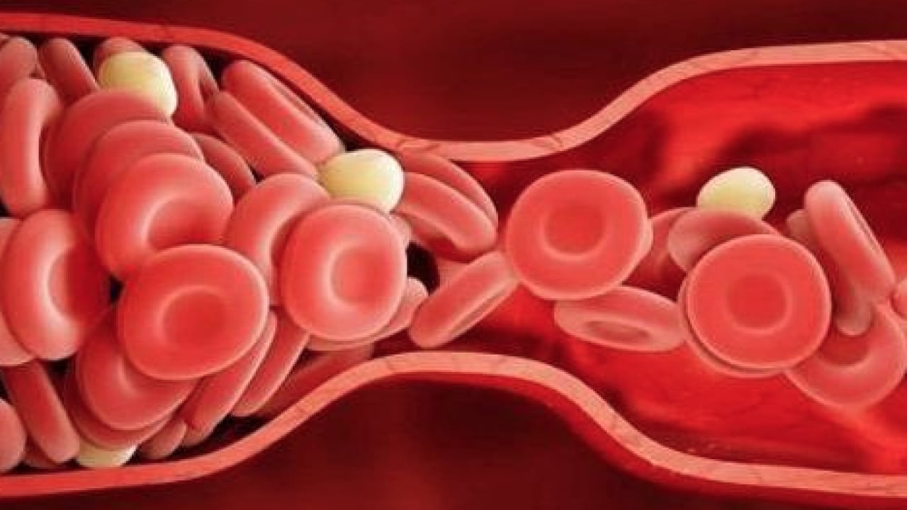 Foto - Profesörden ilgi çeken sözler: Damar yaşınız takvim yaşınızdan daha büyük olabilir