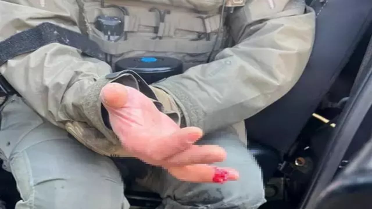 Foto - Protestolara müdahale edilince çileden çıktılar! Polisin parmağını ısırarak kopardılar