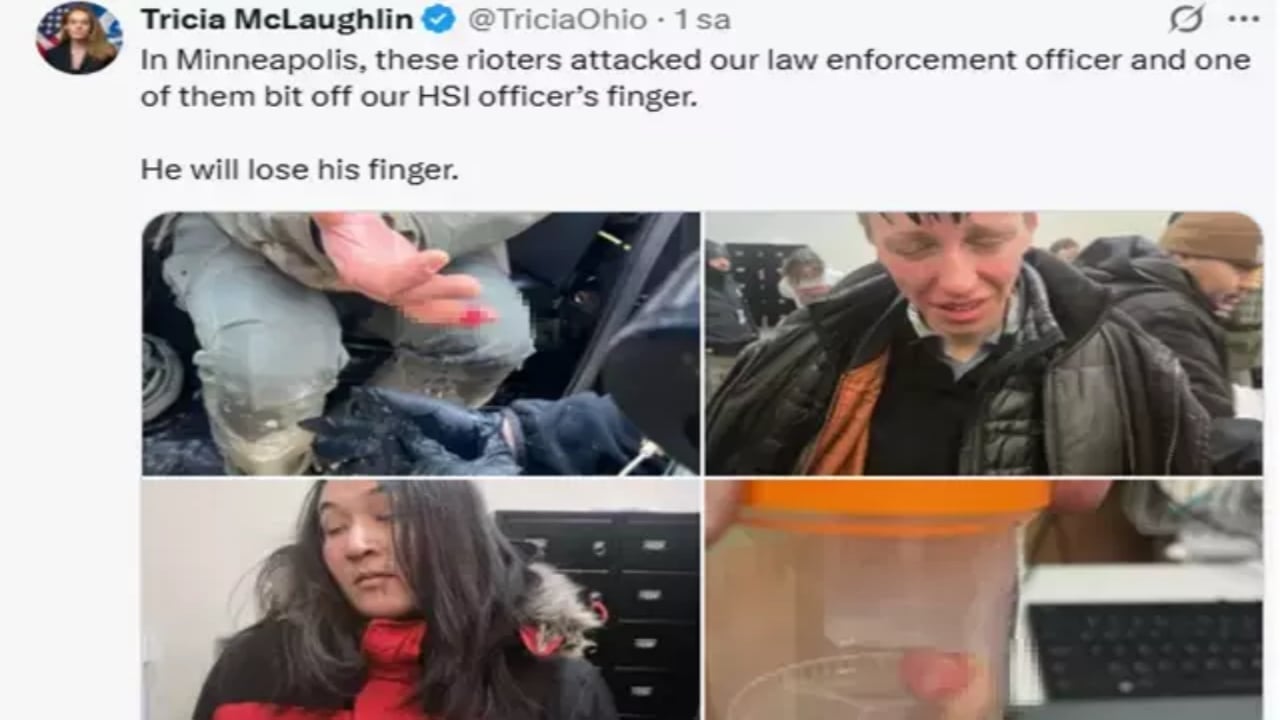 Foto - Protestolara müdahale edilince çileden çıktılar! Polisin parmağını ısırarak kopardılar