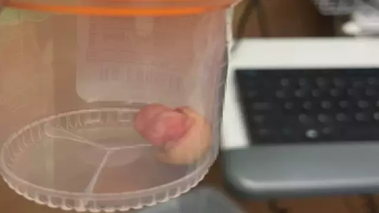 Foto - Protestolara müdahale edilince çileden çıktılar! Polisin parmağını ısırarak kopardılar