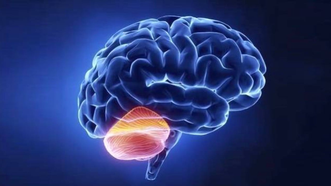 Foto - Psikopatların beyni normalden farklı çıktı!