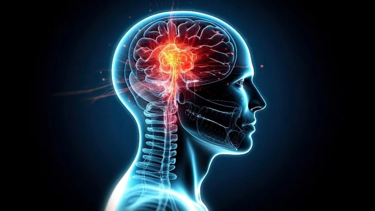 Foto - Psikopatların beyni normalden farklı çıktı!