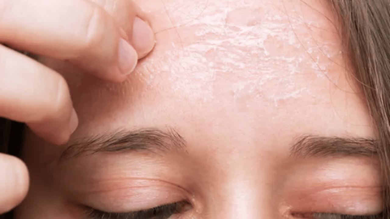 Pürüzsüz cildin formülü bu sebzede saklı! İlk uygulamada çok farklı bir yüze sahip olacaksınız...