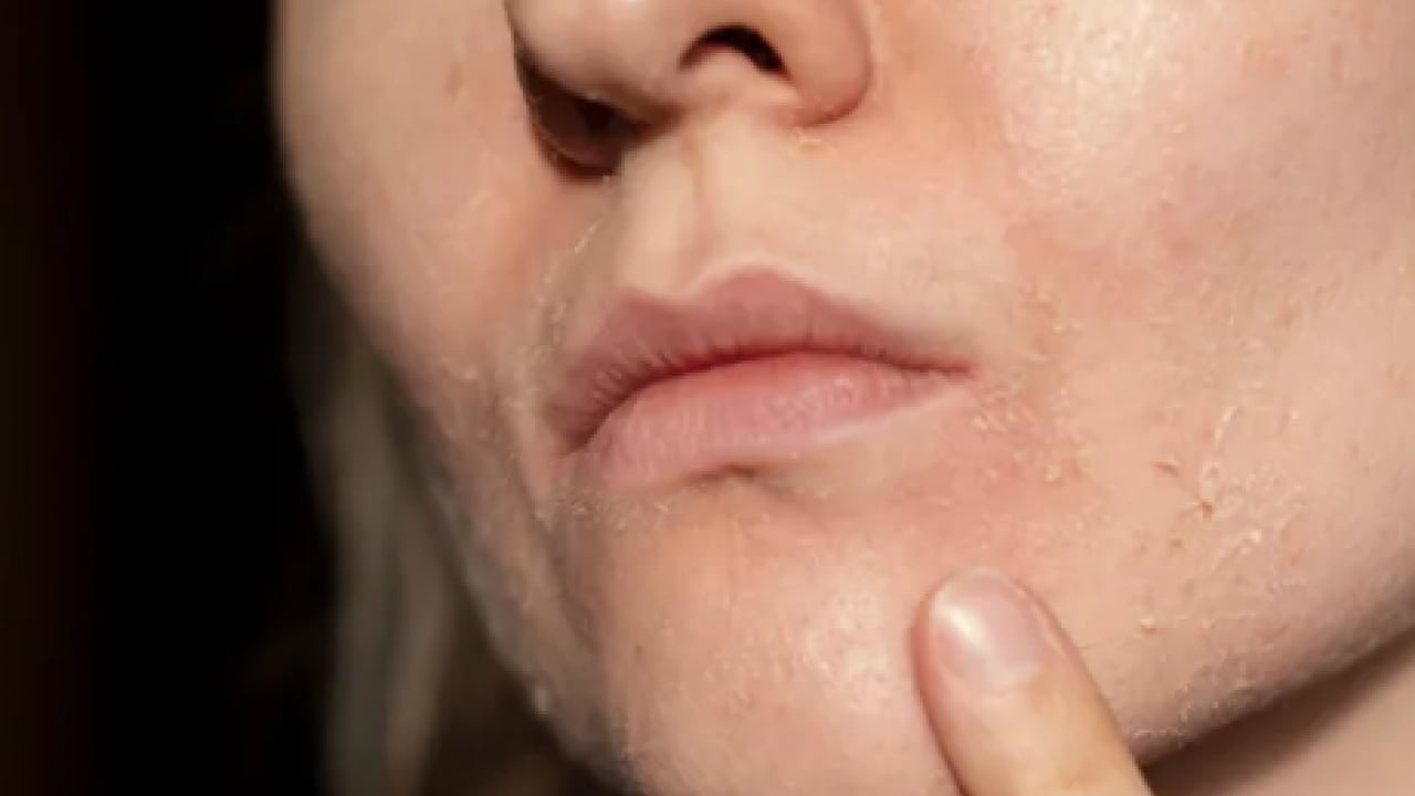 Foto - Pürüzsüz cildin formülü bu sebzede saklı! İlk uygulamada çok farklı bir yüze sahip olacaksınız...