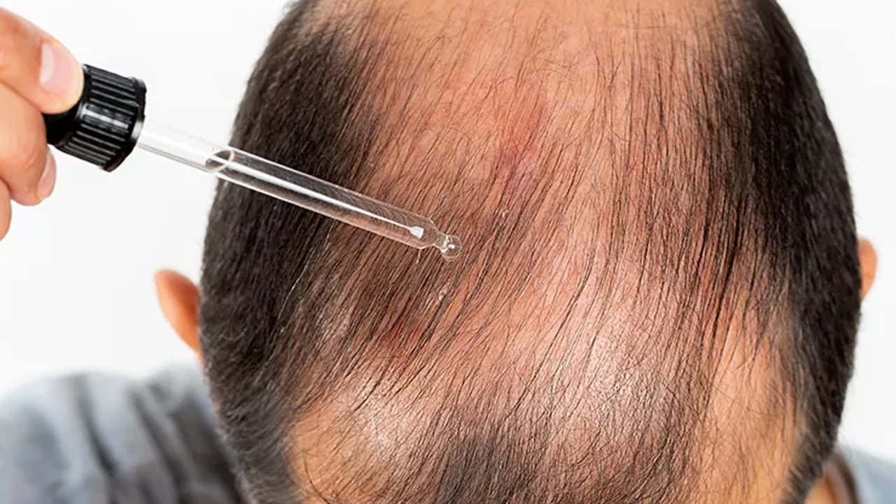 Foto - Raporu araştırmacı açıkladı: Beyaz saça karşı umut görünmüyor mu? Yeni bir araştırma: Sözleri yeniden konuşuldu