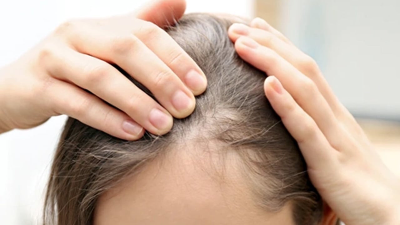 Raporu araştırmacı açıkladı: Beyaz saça karşı umut görünmüyor mu? Yeni bir araştırma: Sözleri yeniden konuşuldu