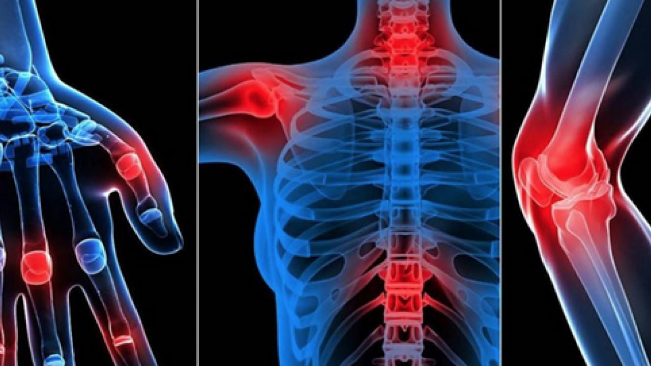 Foto - Romatoloji uzmanı anlattı: Romatizmal hastalıklarda yaşam tarzı değişikliği yaşam kalitesini artırıyor