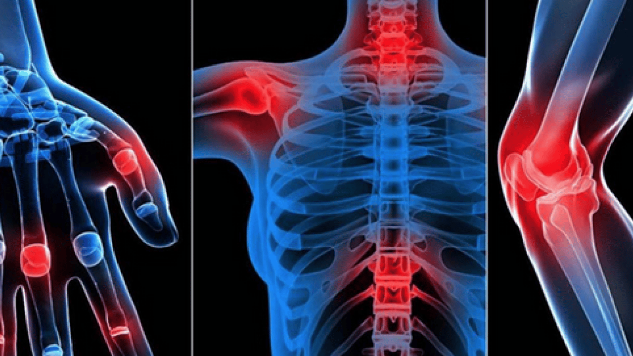 Foto - Romatoloji uzmanı anlattı: Romatizmal hastalıklarda yaşam tarzı değişikliği yaşam kalitesini artırıyor