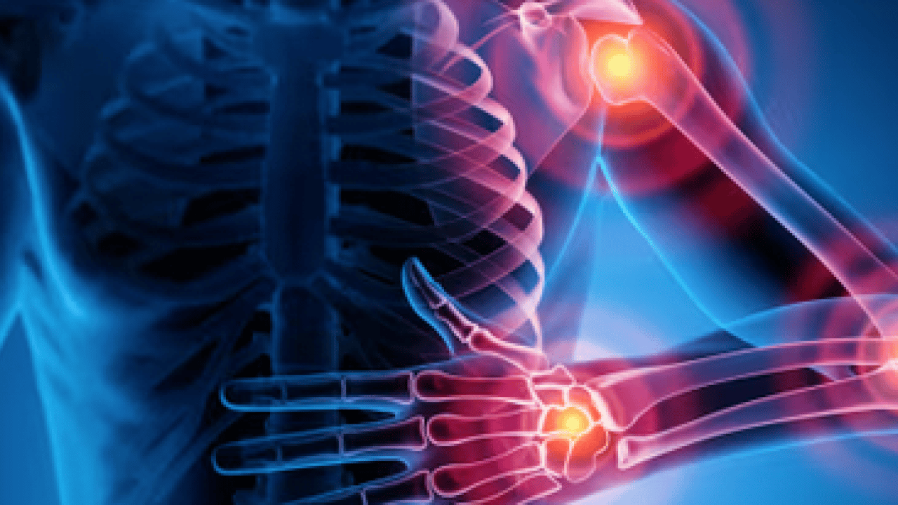 Foto - Romatoloji uzmanı anlattı: Romatizmal hastalıklarda yaşam tarzı değişikliği yaşam kalitesini artırıyor