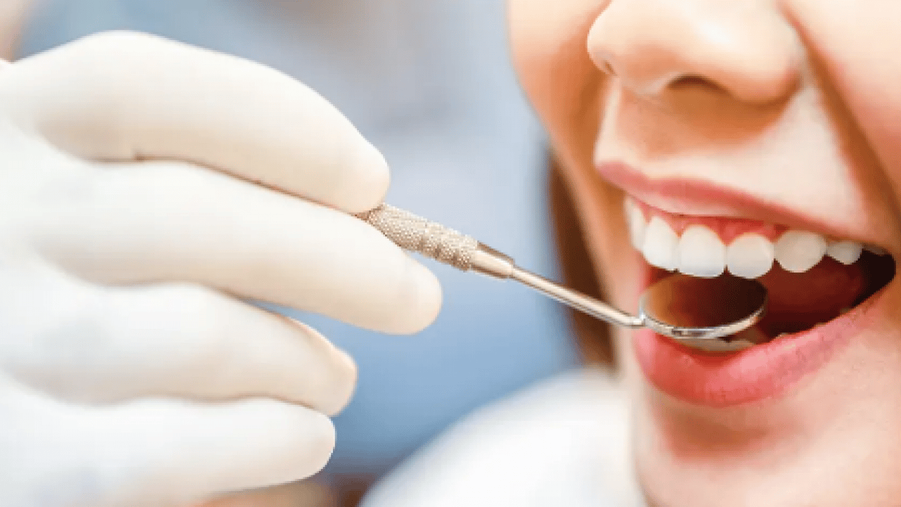 Foto - Rutin kontroller mi yoksa? Diş beyazlatma ürünleri efsane mi gerçek mi?