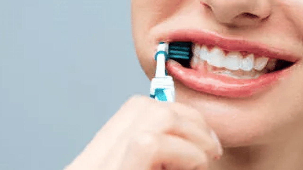 Foto - Rutin kontroller mi yoksa? Diş beyazlatma ürünleri efsane mi gerçek mi?