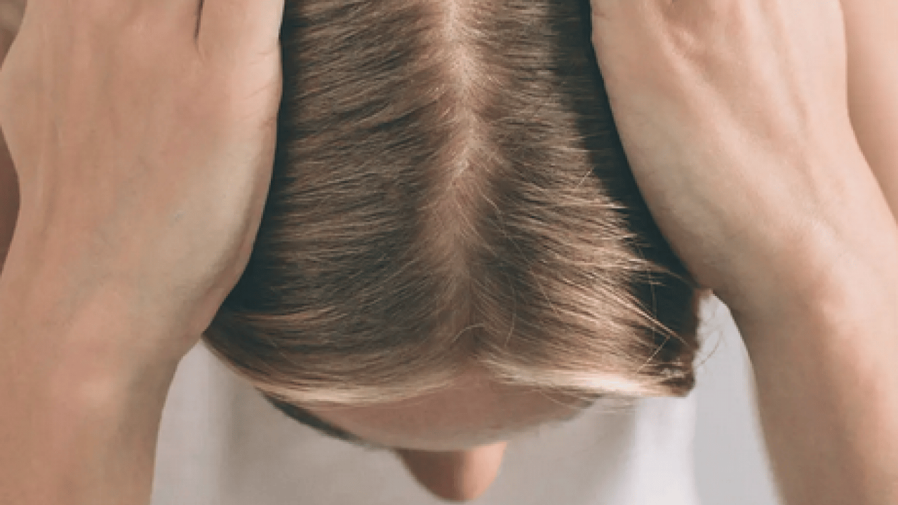 Foto - Saç dökülmesi olanlar dikkat! Tutam tutam saçları dökülenler bu konuyu düşünmeli...