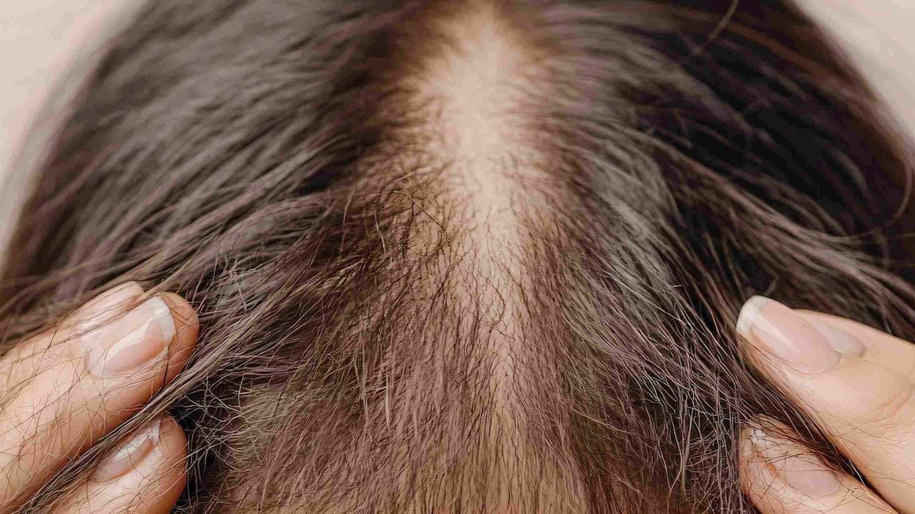 Foto - Saç dökülmesinde doğru bilinen yanlış: Zararlı maddeleri sessiz sedasız içine çekiyor