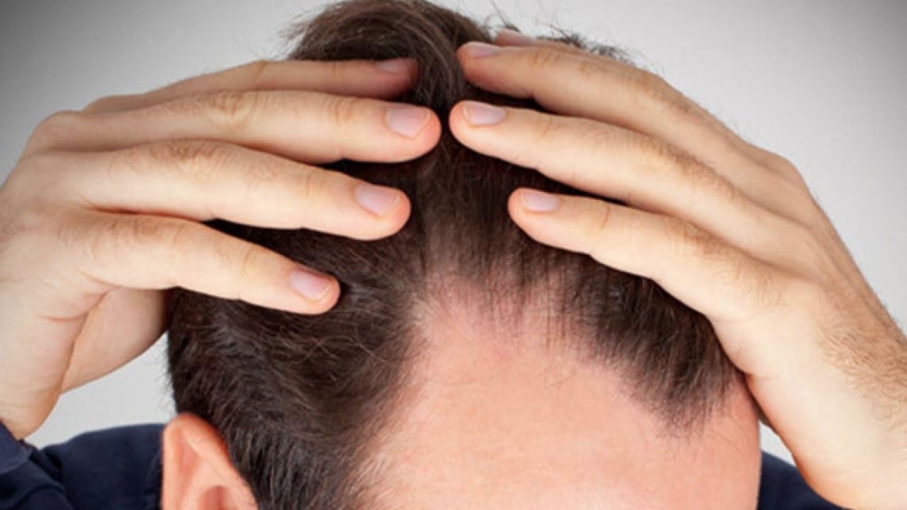 Foto - Prof. Dr. Saç bakımı nasıl yapılır açıkladı! Saç dökülmesine Mezoterapi uygulama fayda edecek! Bunları tercih etmeliyiz