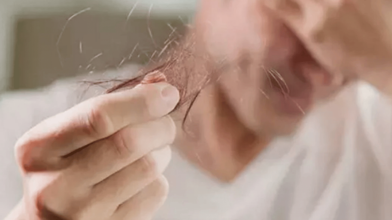 Foto - Prof. Dr. Saç bakımı nasıl yapılır açıkladı! Saç dökülmesine Mezoterapi uygulama fayda edecek! Bunları tercih etmeliyiz