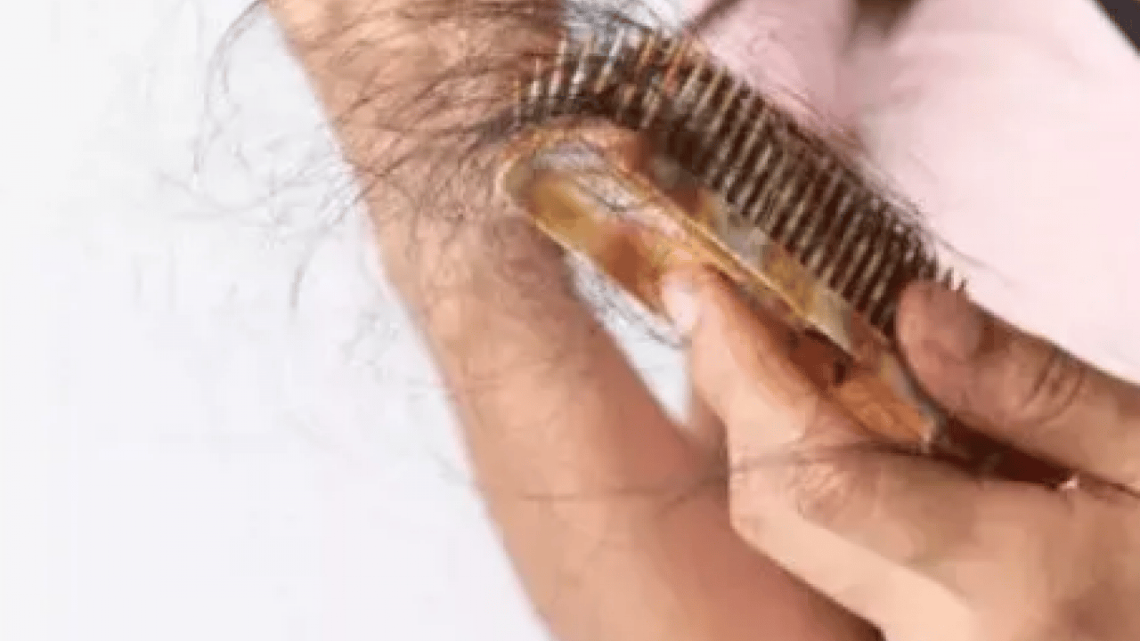 Foto - Prof. Dr. Saç bakımı nasıl yapılır açıkladı! Saç dökülmesine Mezoterapi uygulama fayda edecek! Bunları tercih etmeliyiz