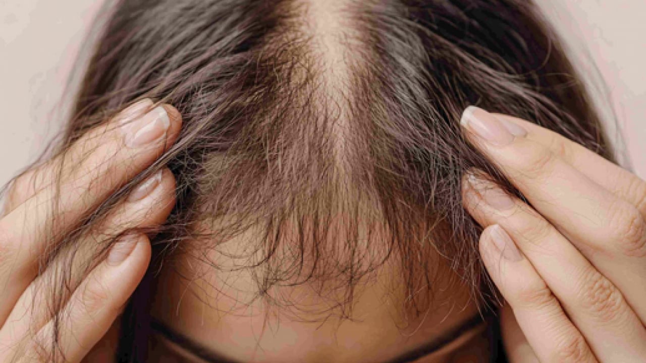 Foto - Saç dökülmesine karşı doğal devrim... Müthiş gelişme! Saç kökleri uyanacak!