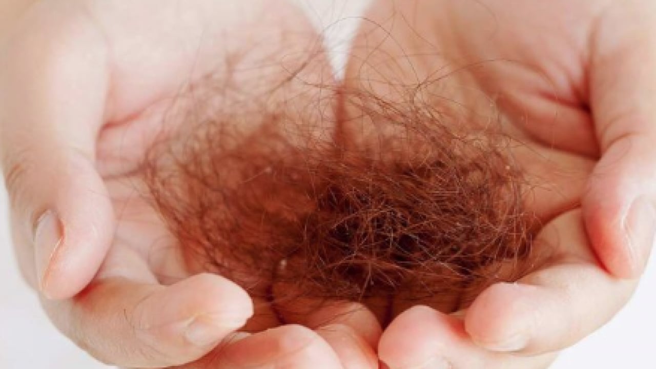 Foto - Saç dökülmesine karşı doğal devrim... Müthiş gelişme! Saç kökleri uyanacak!