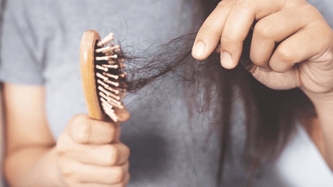 Foto - Saç dökülmesine neden oluyor: D vitamini eksikliği için çözüm yok değil var, bir kez ilave edin! Kellik son bulacak