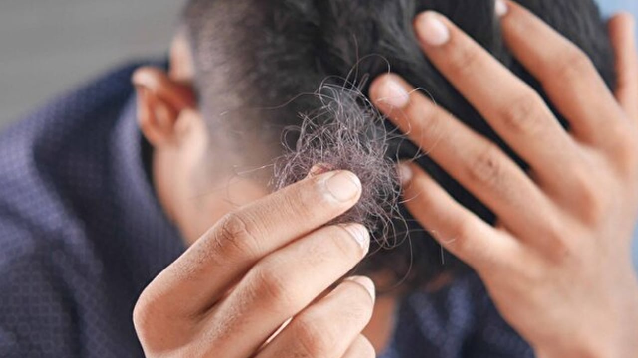 Foto - Saç dökülmesini hızlıca kesiyor: Bu yiyecek saç dökülmesini anında durduruyor! Büyük bir etkiye sahip olduğu biliniyor!