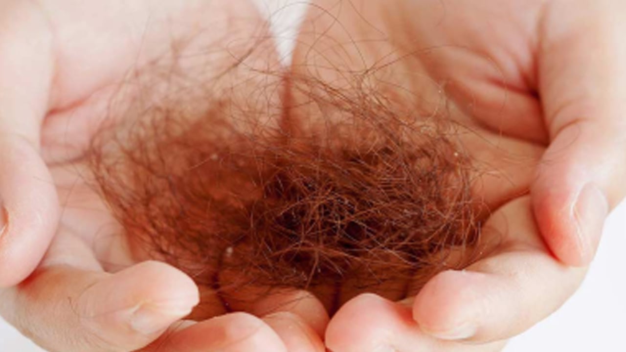 Foto - Saç dökülmesini hızlıca kesiyor: Bu yiyecek saç dökülmesini anında durduruyor! Büyük bir etkiye sahip olduğu biliniyor!